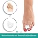 DR.Care Bunion Splints, Toe Separators [2 Pair] - Bunion Corrector - Big Toe Spacers - Elastic Foot Straightener - Bunion Relief - Orthopedic Brace Pads, Gel Toe Spacers For Hallux Valgus - Women, Men