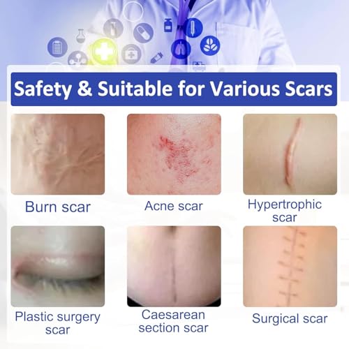 Silicone Scar Removal Sheets (1.6''x 120'', 3M), Professional Upgrade Silicone Sheet for Scars Caused by C-Section, Surgery, Burn, Acne, Stretch Marks, Works on Old & New Scars, Reusable Scar Sheets