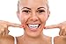 Professional Strength Teeth Whitening Kit Includes XL Syringes Duplex Mouth Tray LED Accelerator Light 5 Syringe Kit