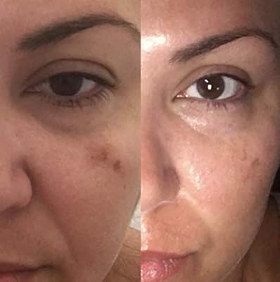 divine dark spot corrector