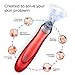 Blackhead Remover – Pore Vacuum Suction Cleanser & Pimple Popper – Comedone Extractor Acne Removal Cleansing Tool by Noel – Includes 5 Heads, 2 Silica Gel Rings, 5 Sponges – Unisex Facial Clean Kit