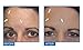 Omiera Glocione Skin Wrinkle Cream and Anti Aging Eye Cream (pack of 2)