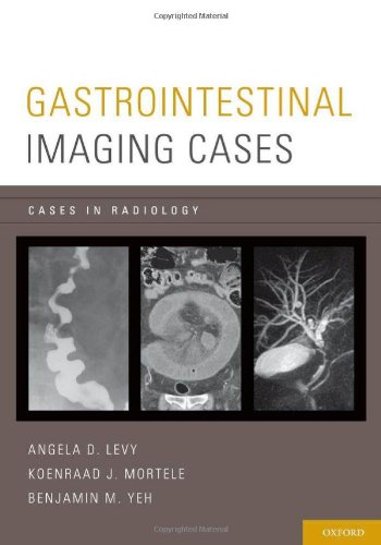 Gastrointestinal Imaging Cases (Paperback)