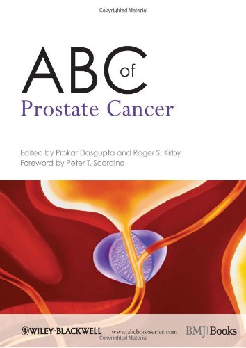 ABC of Prostate Cancer