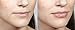 WUNDERKISS - Lip Plumping Gloss with Plumping Booster