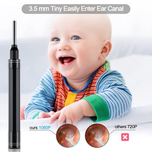 Ear Wax Removal Tool Camera - Ear Camera Ultra Clear View Ear Cleaner Camera 3.5mm Otoscope 1080p Wireless with 6 Led Lights for iPhone Android