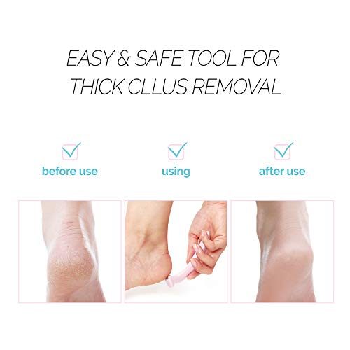 F3 Systems Callus Razor, Pedicure Tool, Effective for Cracked Heel, Ergonomic Design for Easy