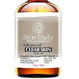 Skin Daily Anti Aging Skin Clearing Serum + 20% Vitamin C, Tea Tree Oil, Niacinamide, Retinol, Salicylic Acid and MSM | Moisturizer, Clears Adult Acne, Age Spots, Scars, Rosacea, Blackheads, Pimples