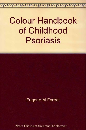 Colour Handbook of Childhood Psoriasis