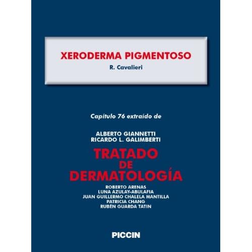 Capítulo 76 extraído de Tratado de Dermatología - XERODERMA PIGMENTOSO Capítulo 76 extraído de Tratado de Dermatología - XERODERMA PIGMENTOSO