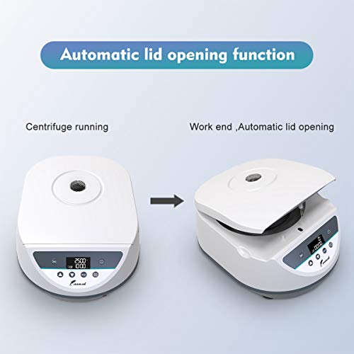 Lab Benchtop Centrifuge Machine Large PRP Centrifuges 10ml/15ml *6 Capacity,5005000rpm(Max