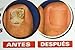 Unesia Bifonazol Combo: Cream & Talcum Fungus Treatment To Aid Fungus Toe Nails