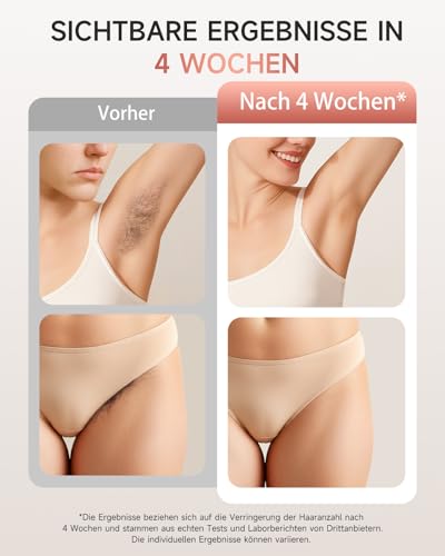 Haarlosy IPL Devices Hair Removal Laser for Men and Women, 999,900 Light Pulses, 3 Functions HR/SC/RA and 9 Energy Levels, Painless Hair Removal for Body, Face, Bikini Area