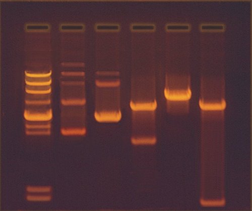Edvotek 301 Construction and Cloning of a DNA Recombinant - Thumbnail 2