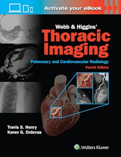 Diagnostic Imaging: Chest: 9780323796637: Medicine & Health