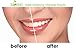 Sky Organics Teeth Whitening Activated Coconut Charcoal Powder (2oz) - Natural Teeth Whitening with No Sensitivity- For a Whiter & Brighter Smile