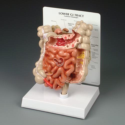 GI Tract Model Lower GI