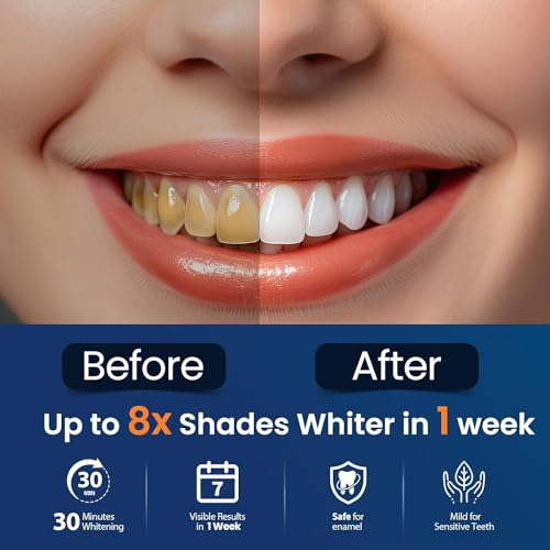 Teeth Whitening Strips Teeth Whitening (Bright Blue 66)