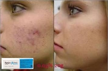 johnson face cream for dark spots