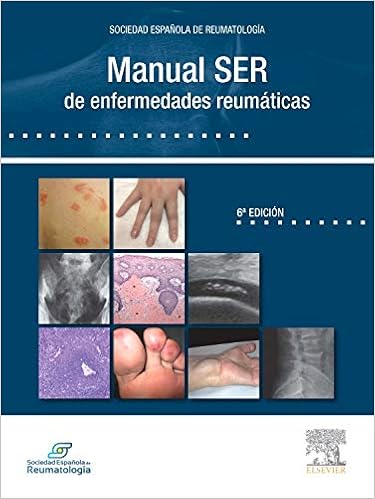 Manual Ser De Enfermedades Reumaticas Varios Autores 9788490229033 Amazon Com Books