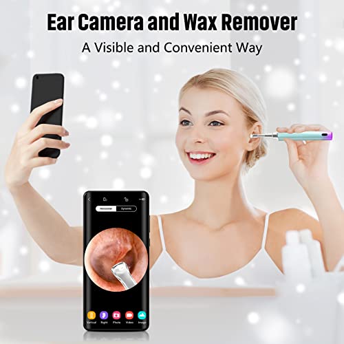Ear Wax Removal Tool Camera, Earwax Removal Kit Endoscope Otoscope with