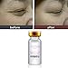 Coerni100% Pure Extract Hyaluronic Acid Serum - Strong Anti Wrinkle, Anti Aging,Hydrating and Whitening 10ml