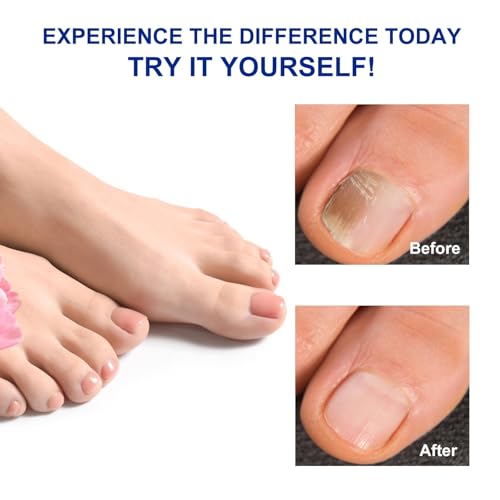 Lboylove® 32 Pcs Fungal Nail Patches, Nighttime Toenail Fungus Treatment, 8-Hour Overnight Repair, Anti Repair And Strengthen, Suitable For Men Women