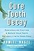 Cure Tooth Decay: Remineralize Cavities and Repair Your Teeth Naturally with Good Food