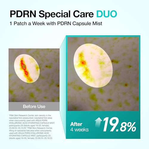 ANUA Salmon DNA PDRN Collagen Melting Patch for Glass skin, Smile Line Patches, Wrinkle Patches, Melting Thin Collagen Patch, Firming for Fine Lines, Glow, Korean Skincare, 2 Pairs x 4EA, Patch Only