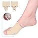 Yosoo Bunion Sleeve Protector Metatarsal Toe Pad Forefoot Cushion Socks Bunion Booties for Women Men- Hallux Valgus, Hammertoe,Pain Relief, One Size