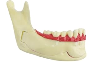 Dental Endodontic Treatment Model Mandible Tissue Anatomical Model Anatomy of Gums Dentistry Study Oral Care Teach Teeth Mode
