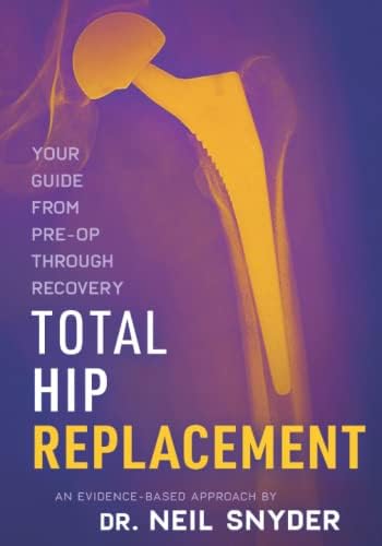 Amazon.com: Revision Total Hip Arthroplasty: 9783031839580: Smith