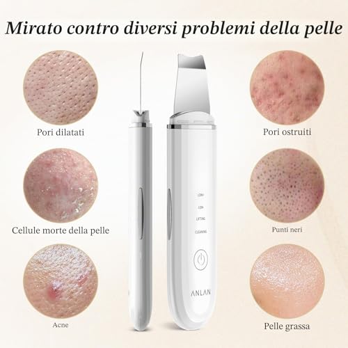 ANLAN Professional Ultrasonic Facial Cleansing Skin Scrubber for Deep Cleansing the Face Peeling and Care, 4 Modes Blackhead Removal, USB Rechargeable