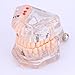 Tooth Model, Disease Teaching Study Adult Typodont Demonstration Teeth Model New