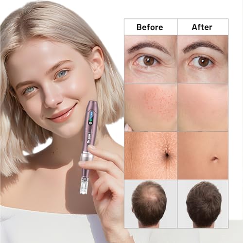 Dr. Pen A10 Professional Microneedling Pen with 25 Replacement Cartridges, 5 Levels and LED Dermapen Display for Hair Growth, Face, Body and Skin Care