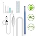 Skybasic Ear Otoscope Inspection Camera 3 in 1 USB Ear Cleaning Endoscope Tool Visual Earpick Digital Earwax Removal Spoon with 6 LED for Micro USB,USB-C Android Phone,Windows MAC PC