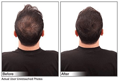 image for JUVEKER Hair Building Fibers Hair Loss Concealer for Men & Women - 28 