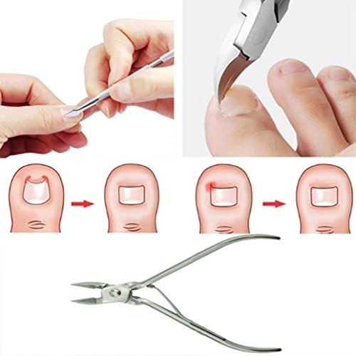 AutumnFall Foot Care Tool,2Pcs Ingrown Toe Nail Correction Nippers Clipper Cutters Dead Skin Dirt Remover + Paronychia Podiatry Pedicure Care Tool Set (Silver)