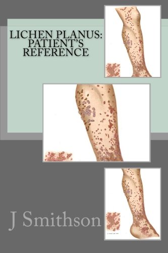 Lichen Planus Patient S Reference Smithson Ma J P 9781467927314 Amazon Com Books