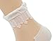 Lovful 3 Pairs Women's Ultrathin Transparent Lace Elastic Short Socks,Multi Color
