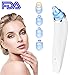 Blackhead Remover Vacuum Suction Facial Pore Cleaner, Sisha Electric Acne Comedone Extractor Kit with 4 Suction Heads for Women and Men Black Heads Sucker