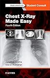 Chest X-Ray Made Easy