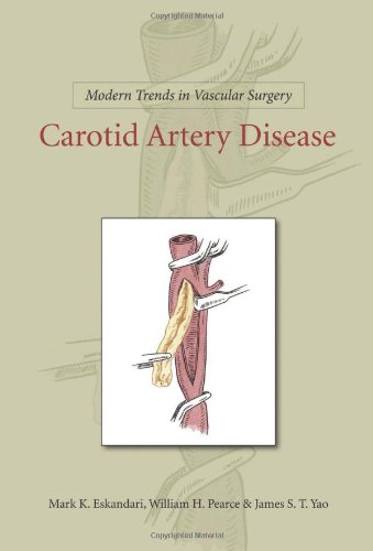 MODERN TRENDS IN VASCULAR SURGERY: CAROTID ARTERY DISEASE