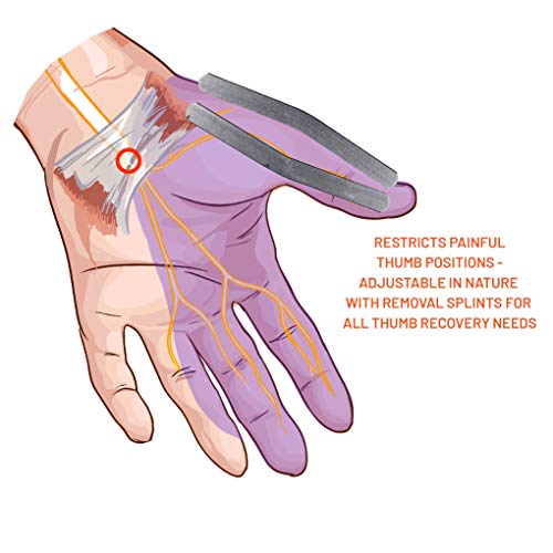 CMC Joint Thumb Splint for Arthritis and Carpal Tunnel Syndrome by Everyday Medical I Thumb Immobilizer Brace for Arthritis, Carpal Tunnel, CMC Joint, and Tendonitis I Stabilizer Support Splint
