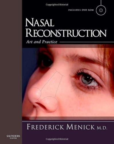 Download Nasal Reconstruction: Art and Practice PDF