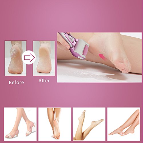 Denicer Pedicure Foot File Professional Electric Callus Remover Wet and Dry Use Feet Care Tool, 3 extra Grinding Heads, USB cable, No Charger (Rose Gold). ...