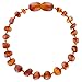 Baltic Amber Teething Bracelet or Anklet for Babies, Toddlers, and Kids - Lab-Tested - Raw Unpolished Cognac - 5.5 Inches