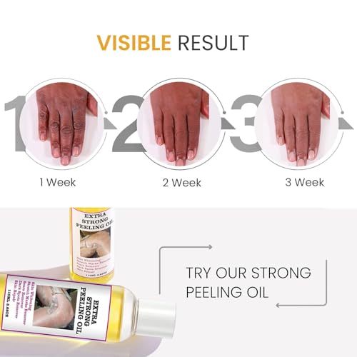 LBOYLOVE® 2 Pcs Yellow Peeling Oil, Extra Strong Peel Oil for Dark Skin with Camellia Leaf, Licorice Root and Chamomile Extract for Body Hand Foot, for All Skin Types