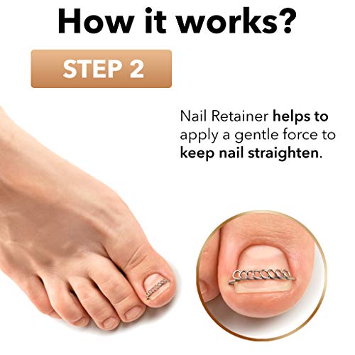 Dr. Krause Ingrown Toenail Treatment Kit Stainless Steel Pedicure Tools