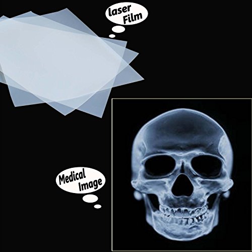 200 Sheets,8.5"x11",Laser Printing Transparency Film for Silk Screen Printing
